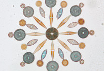 “Diatoms” Photo credit: W.M. Grant